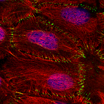 Normal human keratinocytes (Keratin14 red; Desmoplakin green, Nuclei blue), LSM780-Airyscan , ZEN-3D, [Katrin Rietscher]