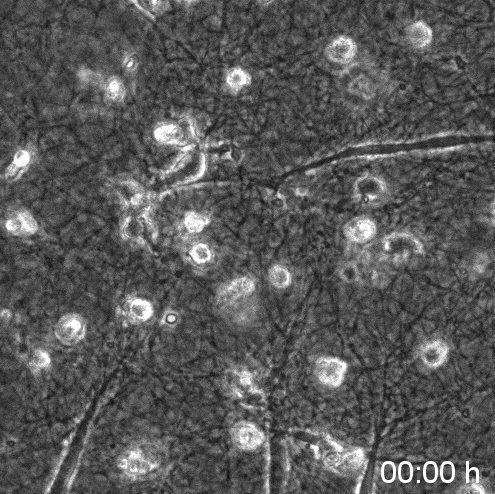 macrophages & fibroblasts in a 3D collagen matrix, Zeiss AxioObserver.Z1, 3D long-term tracking [Katja Franke]